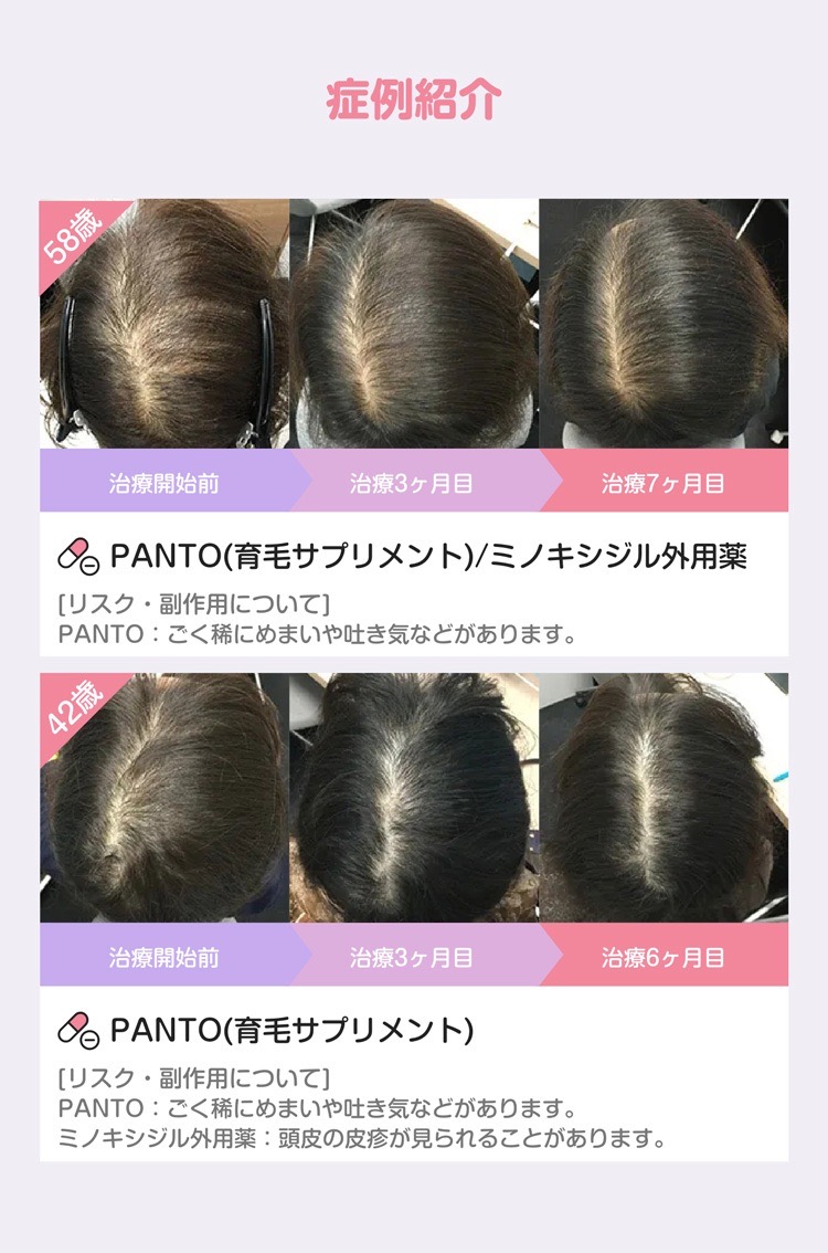 症例紹介
